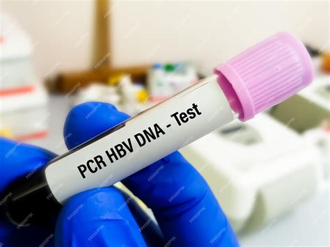 HBV DNA Quantitative, Quantitative PCR .